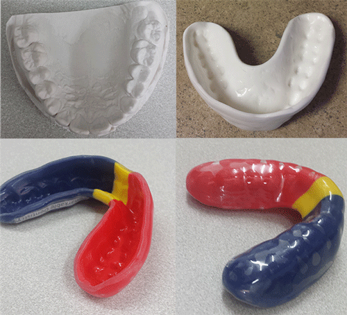 Mouth Guards  North Adelaide Dental Care